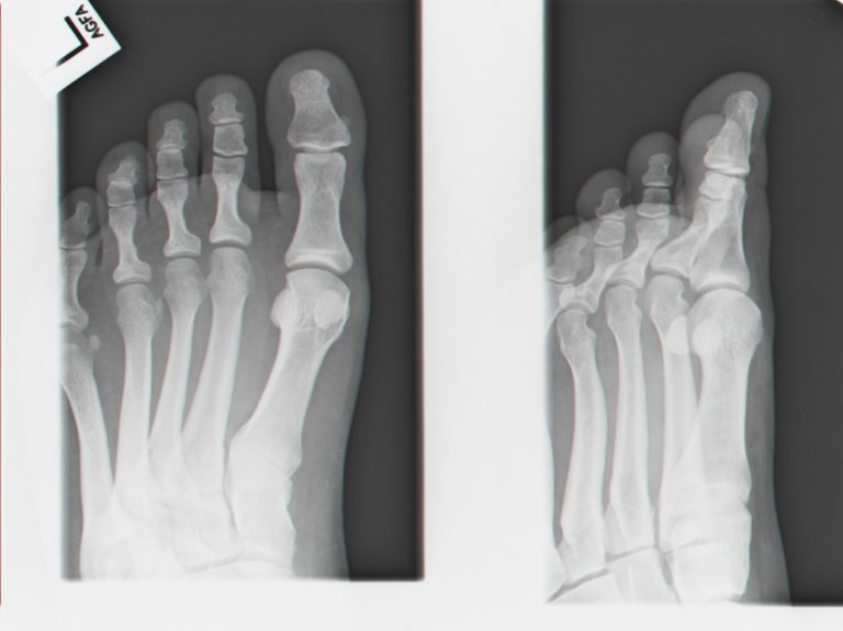 GR getting an X-Ray
